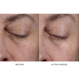 Eye Activator Serum