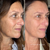 Suprême C Serum